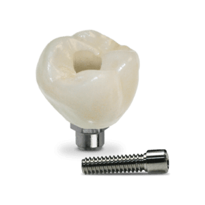 Implants_image
